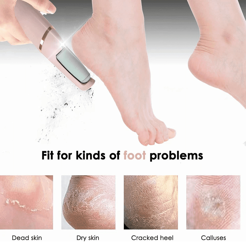 Electric Foot File Callus Remover - IKEA