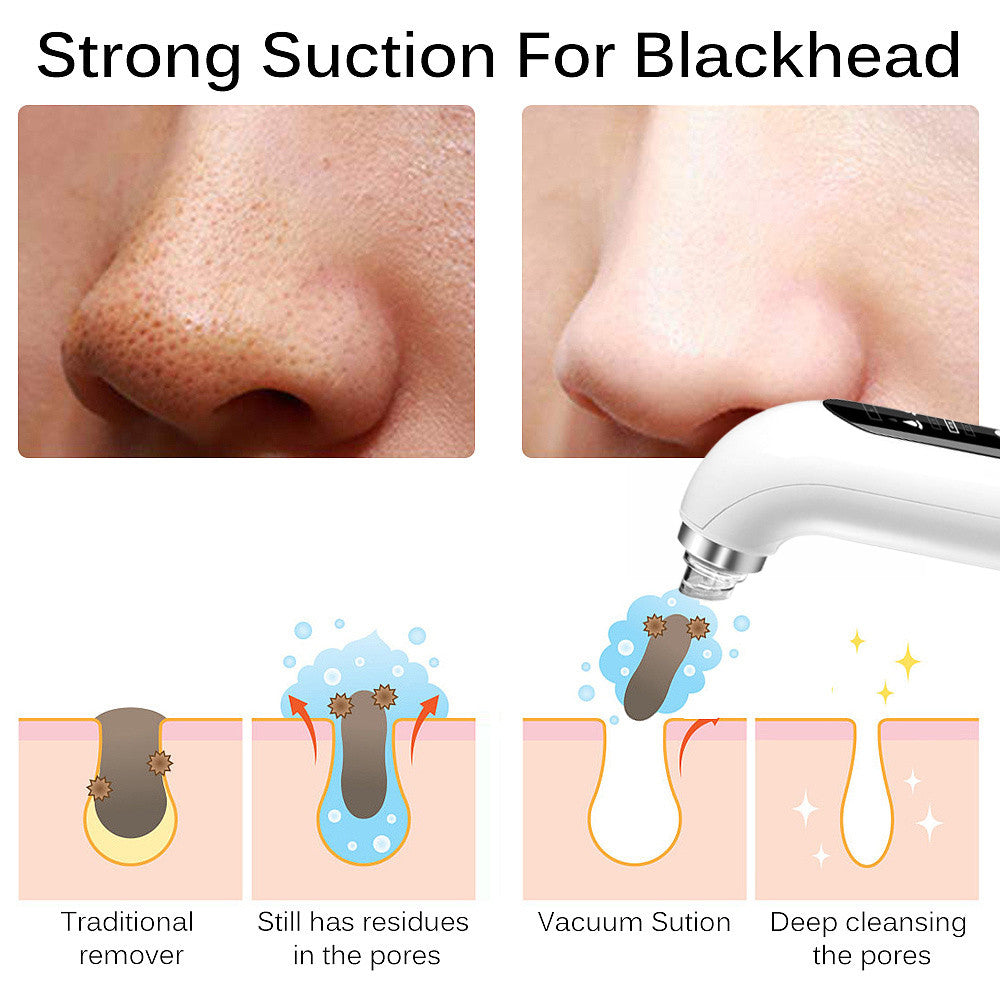 Electric Small Bubble Blackhead Remover - IKEA